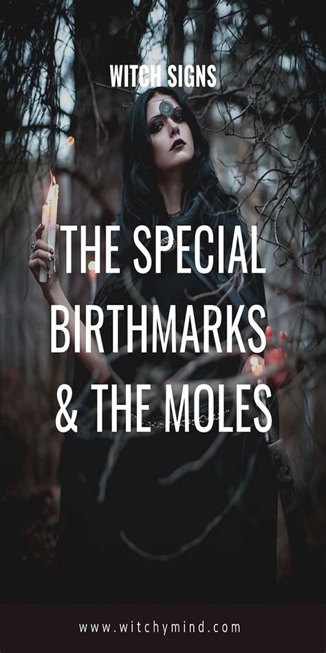 Witch birthmarks: A connection to the spirit world